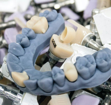 3D Printing in Dentistry: Revolutionizing Dental Care with Digital Precision